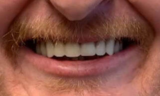 s1